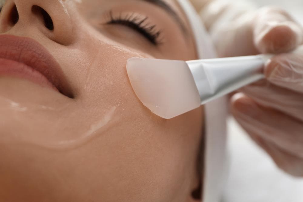 Cómo renovar tu rostro con el peeling facial: ¿qué es, cómo se hace y qué resultados se obtienen?